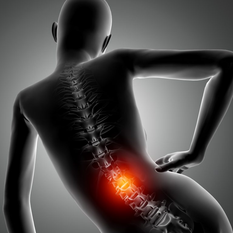 lordosis lumbar